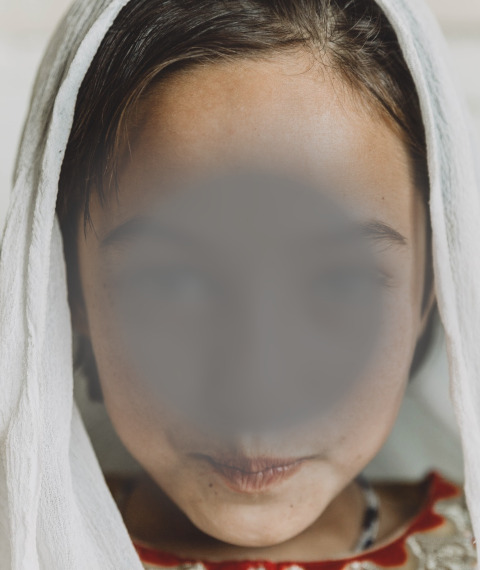 Image of a young girl with a gray blob at the center of her face, simulating visual impairments from AMD