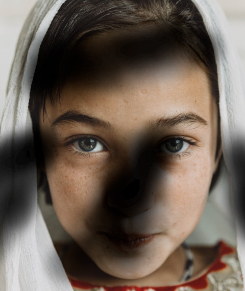 Image of a young girl with dark spots overlaid, simulating visual impairments from diabetic retinopathy