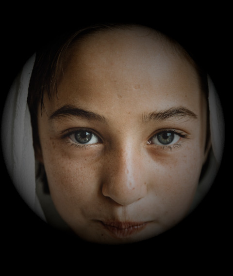 Image of a young girl with a dark vignette, simulating visual impairments from glaucoma